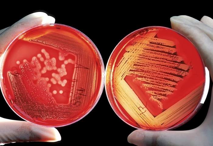 Vase Petri in care se cultivă bacterii
